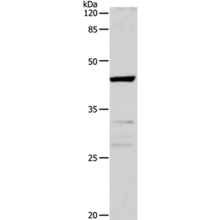 CDK10 Antibody from Signalway Antibody (35677) - Antibodies.com