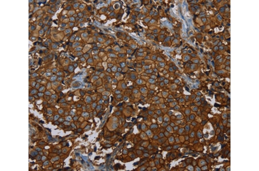 Immunohistochemistry - ERBB4 Antibody from Signalway Antibody (35681) - Antibodies.com