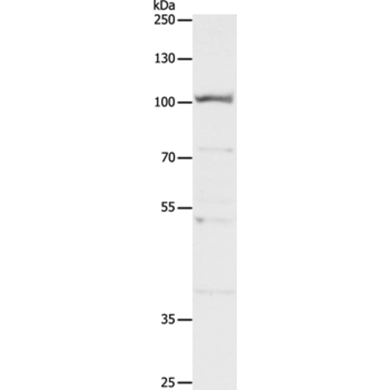 CLCA4 Antibody from Signalway Antibody (35684) - Antibodies.com