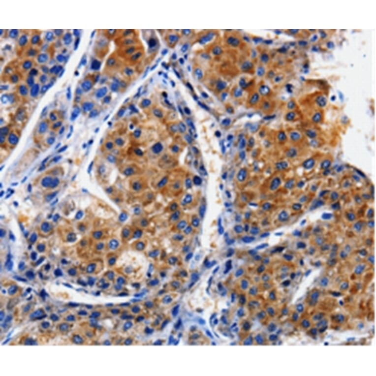 Immunohistochemistry - CLCA4 Antibody from Signalway Antibody (35684) - Antibodies.com