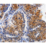 Immunohistochemistry - CLCA4 Antibody from Signalway Antibody (35684) - Antibodies.com