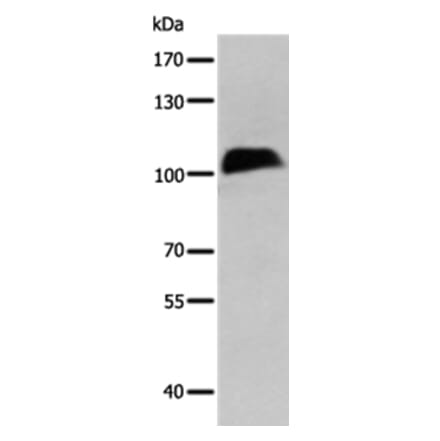 CTBP2 Antibody from Signalway Antibody (35698) - Antibodies.com