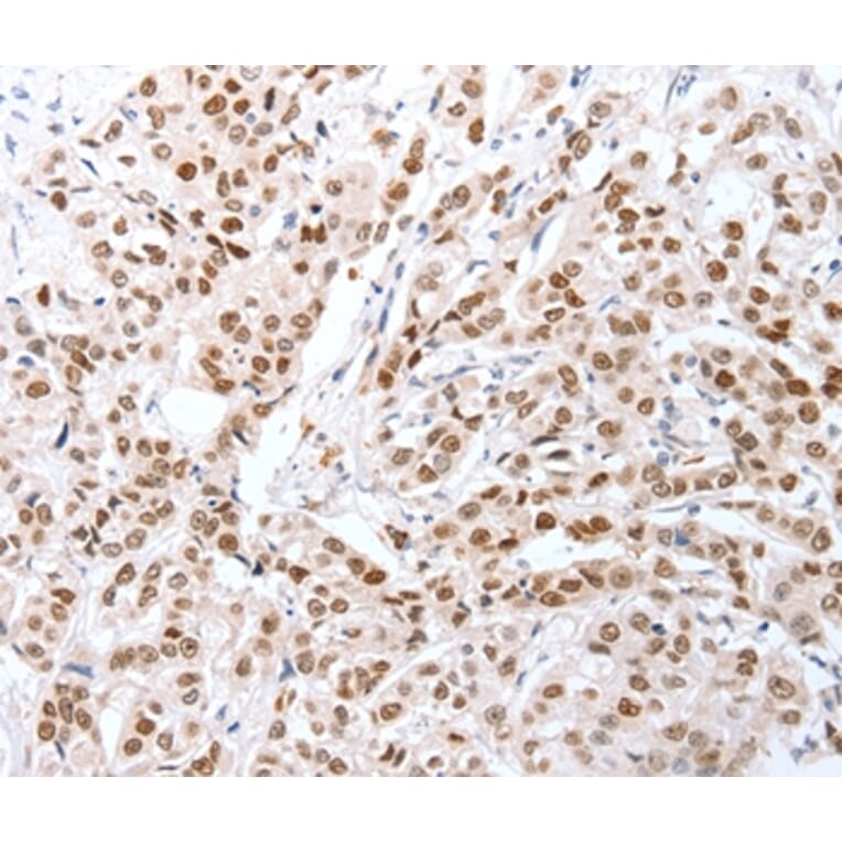 Immunohistochemistry - CTBP2 Antibody from Signalway Antibody (35698) - Antibodies.com