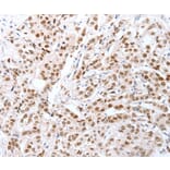 Immunohistochemistry - CTBP2 Antibody from Signalway Antibody (35698) - Antibodies.com
