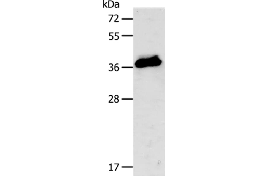 CXCR3 Antibody from Signalway Antibody (35701) - Antibodies.com