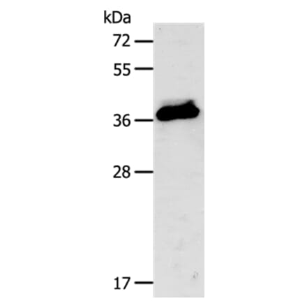 CXCR3 Antibody from Signalway Antibody (35701) - Antibodies.com