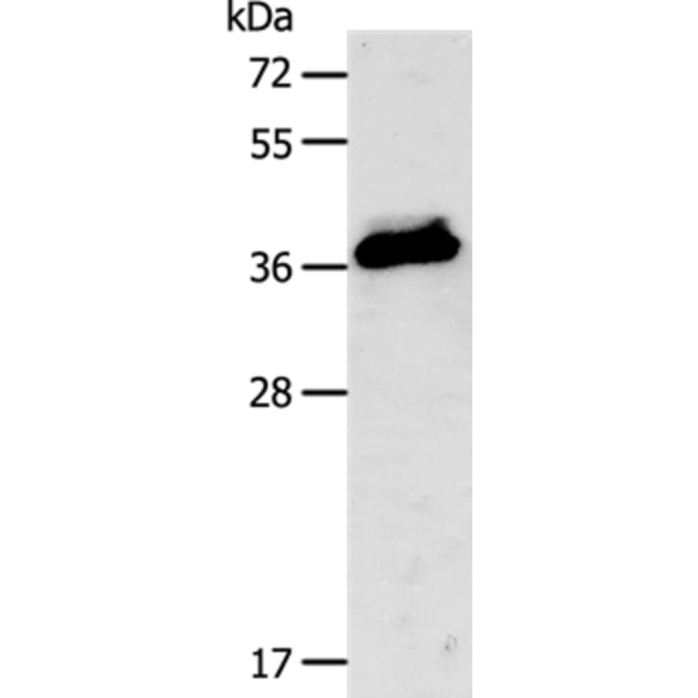 CXCR3 Antibody from Signalway Antibody (35701) - Antibodies.com