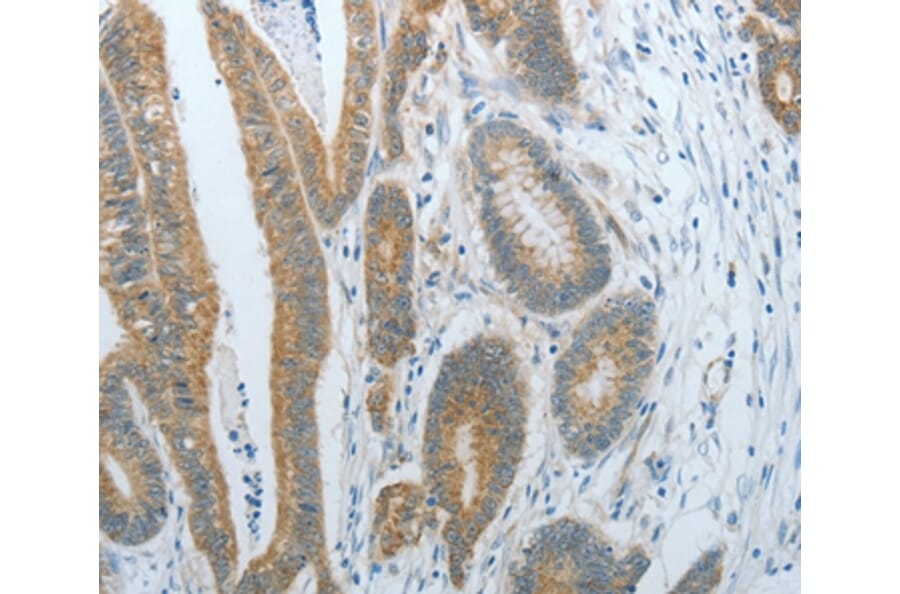 Immunohistochemistry - CXCR3 Antibody from Signalway Antibody (35701) - Antibodies.com