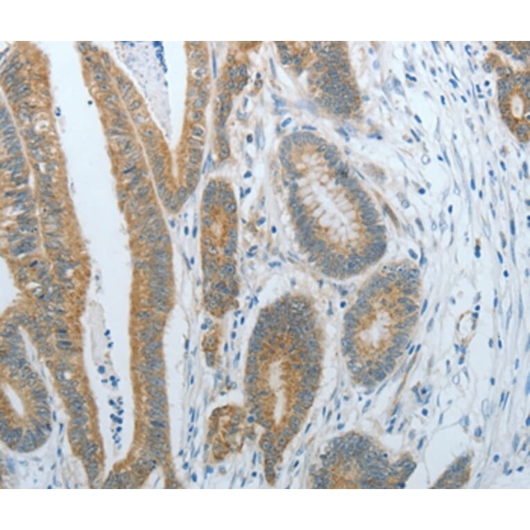 Immunohistochemistry - CXCR3 Antibody from Signalway Antibody (35701) - Antibodies.com