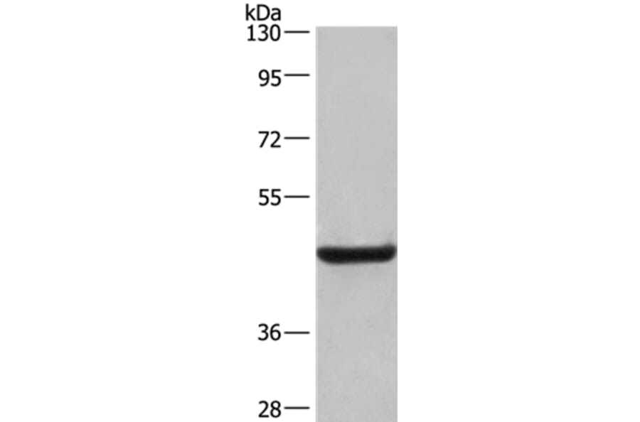 LAMP2 Antibody from Signalway Antibody (35708) - Antibodies.com