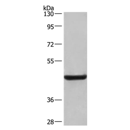 LAMP2 Antibody from Signalway Antibody (35708) - Antibodies.com