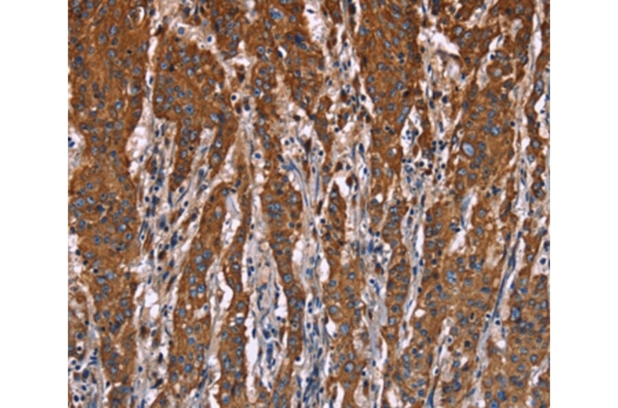 Immunohistochemistry - LAMP2 Antibody from Signalway Antibody (35708) - Antibodies.com