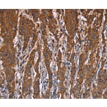 Immunohistochemistry - LAMP2 Antibody from Signalway Antibody (35708) - Antibodies.com