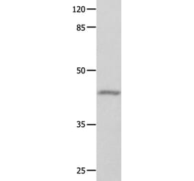 GNA11 Antibody from Signalway Antibody (35744) - Antibodies.com