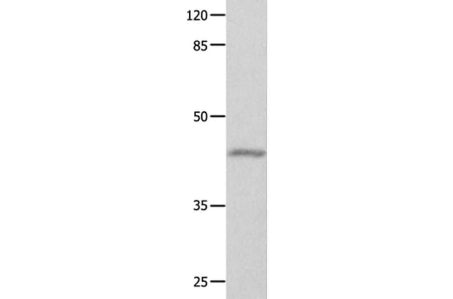 GNA11 Antibody from Signalway Antibody (35744) - Antibodies.com