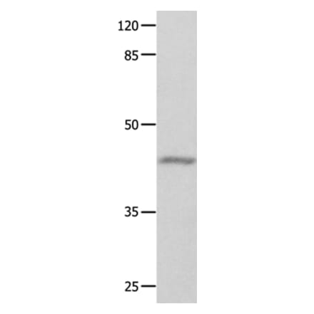 GNA11 Antibody from Signalway Antibody (35744) - Antibodies.com