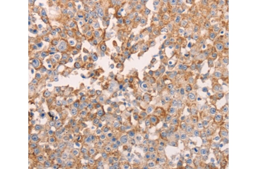 Immunohistochemistry - GNA11 Antibody from Signalway Antibody (35744) - Antibodies.com