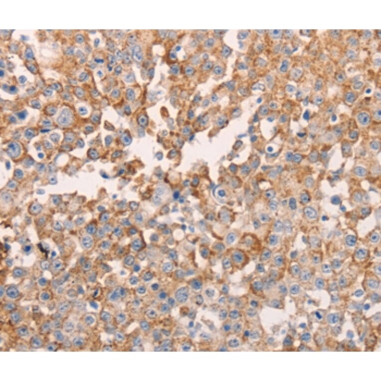 Immunohistochemistry - GNA11 Antibody from Signalway Antibody (35744) - Antibodies.com