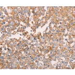 Immunohistochemistry - GNA11 Antibody from Signalway Antibody (35744) - Antibodies.com