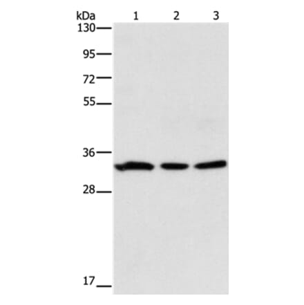 GPA33 Antibody from Signalway Antibody (35759) - Antibodies.com