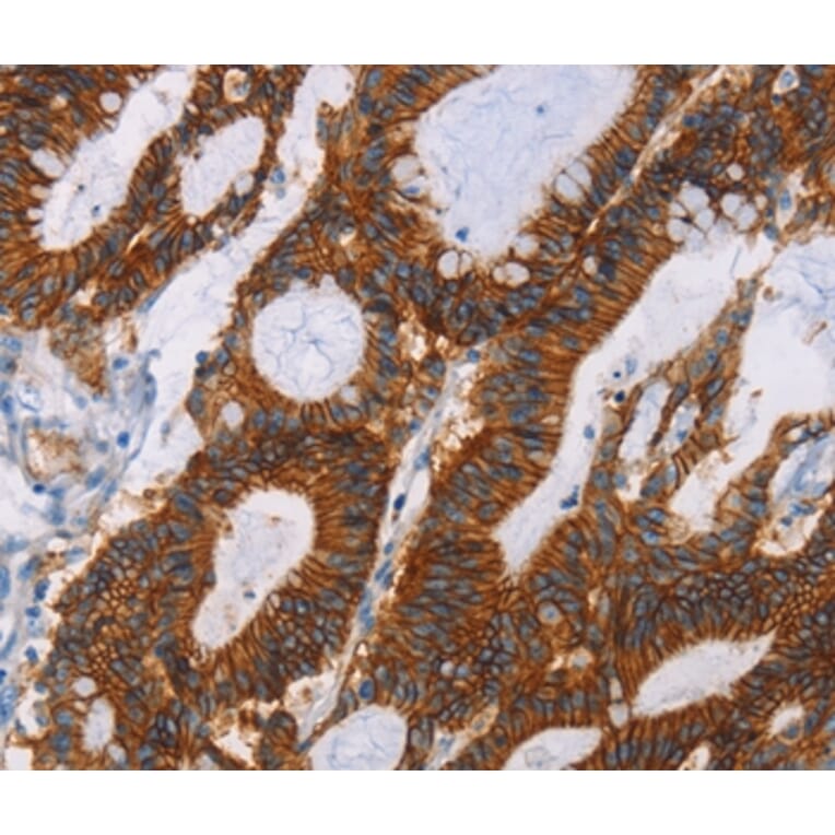 Immunohistochemistry - GPA33 Antibody from Signalway Antibody (35759) - Antibodies.com