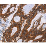 Immunohistochemistry - GPA33 Antibody from Signalway Antibody (35759) - Antibodies.com