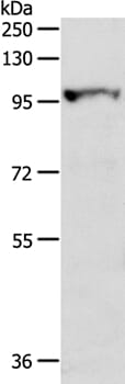 Gel: 8% SDS-PAGE Lysates (from left to right): Human fetal liver tissue Amount of lysate: 40ug per lane Primary antibody: 1/300 dilution Secondary antibody dilution: 1/8000 Exposure time: 30 seconds