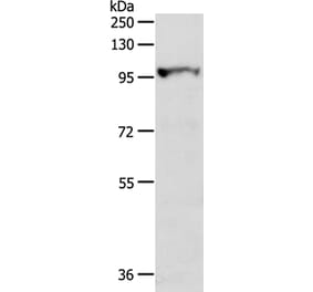 MGEA5 Antibody from Signalway Antibody (35763) - Antibodies.com
