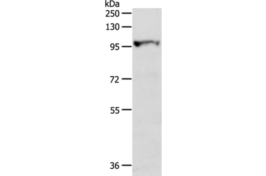 MGEA5 Antibody from Signalway Antibody (35763) - Antibodies.com