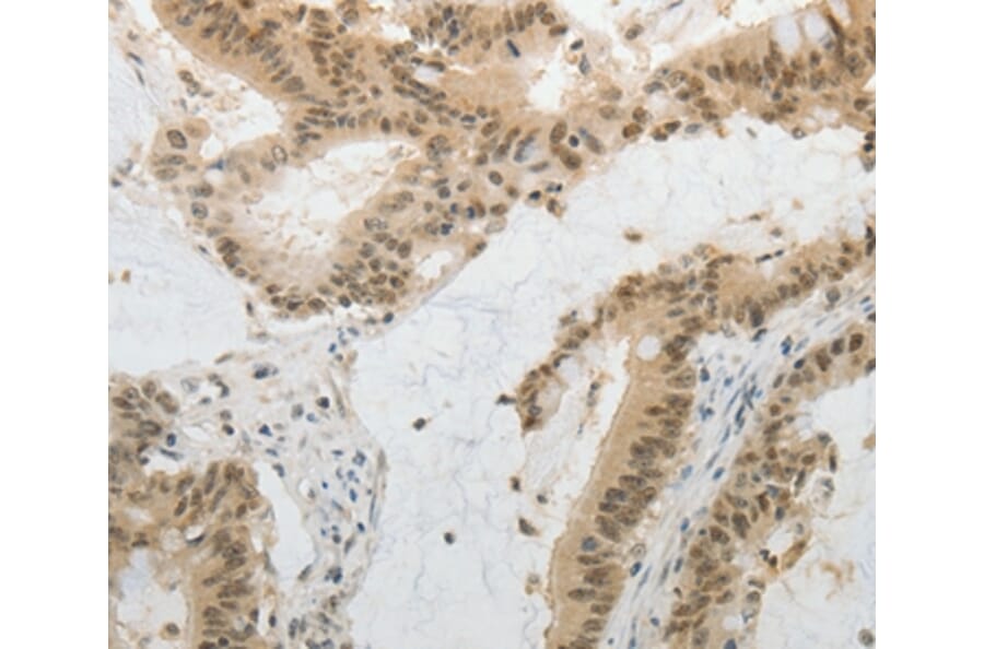 Immunohistochemistry - MGEA5 Antibody from Signalway Antibody (35763) - Antibodies.com