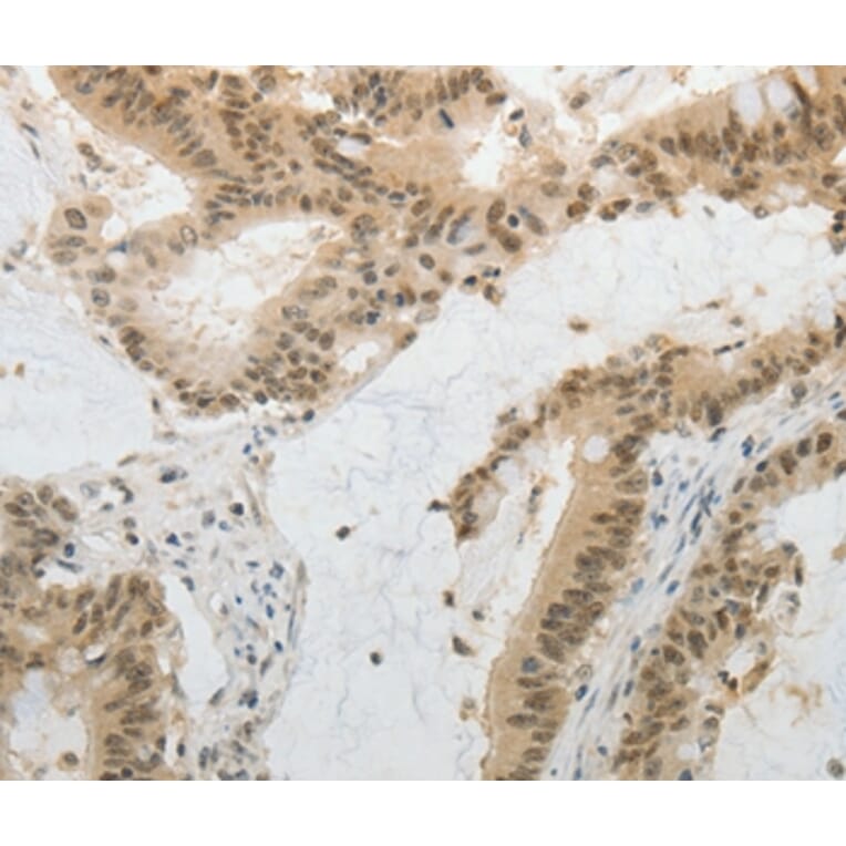 Immunohistochemistry - MGEA5 Antibody from Signalway Antibody (35763) - Antibodies.com