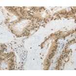 Immunohistochemistry - MGEA5 Antibody from Signalway Antibody (35763) - Antibodies.com