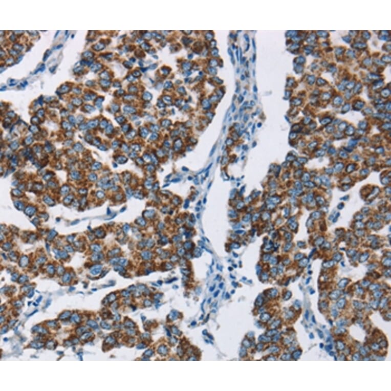 Immunohistochemistry - HINT2 Antibody from Signalway Antibody (35765) - Antibodies.com