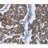 Immunohistochemistry - HINT2 Antibody from Signalway Antibody (35765) - Antibodies.com