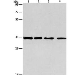 INHBC Antibody from Signalway Antibody (35781) - Antibodies.com