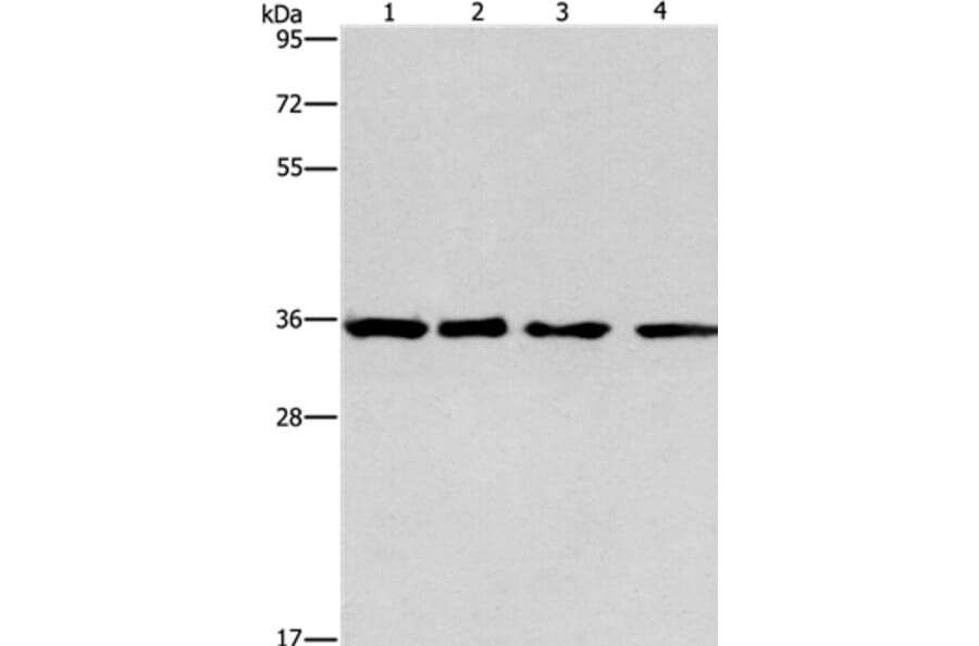 INHBC Antibody from Signalway Antibody (35781) - Antibodies.com
