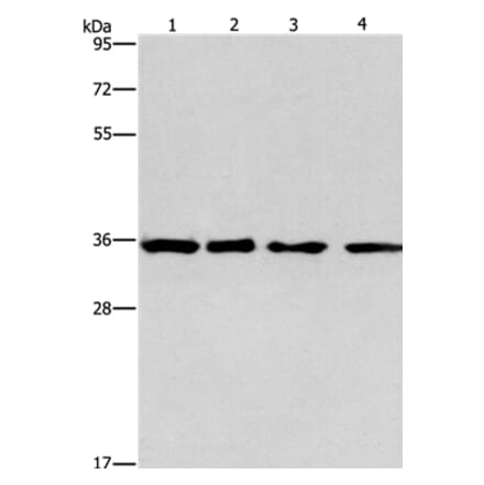 INHBC Antibody from Signalway Antibody (35781) - Antibodies.com