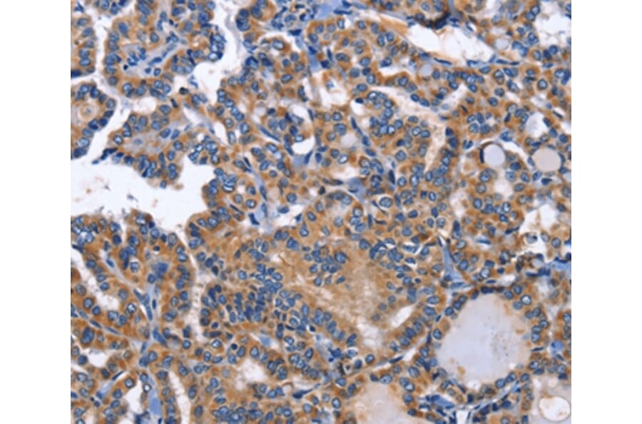 Immunohistochemistry - INHBC Antibody from Signalway Antibody (35781) - Antibodies.com