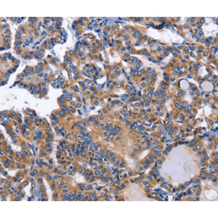 Immunohistochemistry - INHBC Antibody from Signalway Antibody (35781) - Antibodies.com