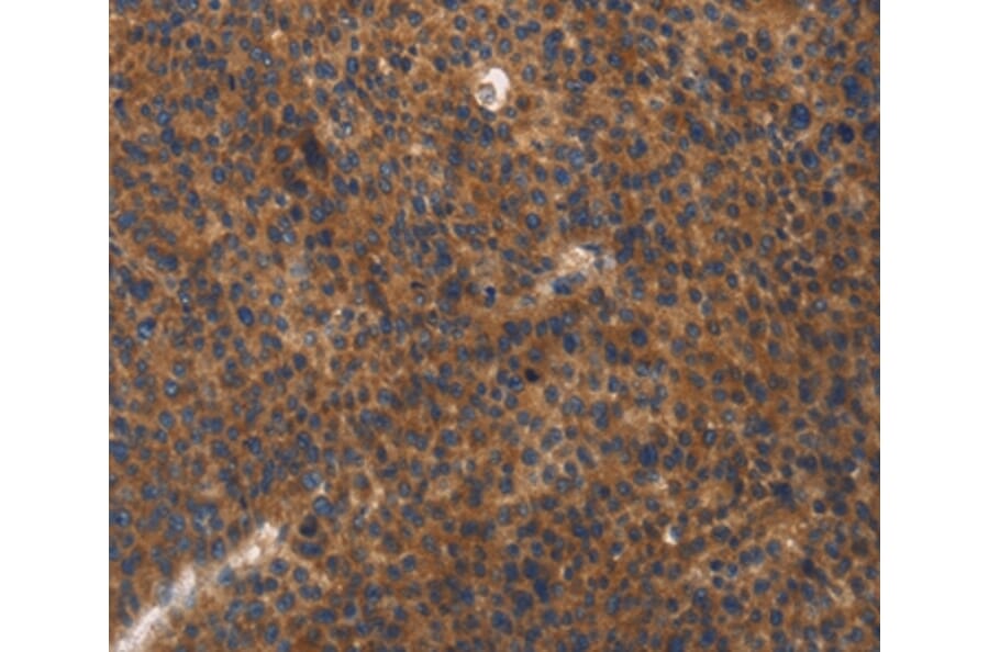 Immunohistochemistry - ITGB3 Antibody from Signalway Antibody (35782) - Antibodies.com
