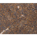 Immunohistochemistry - ITGB3 Antibody from Signalway Antibody (35782) - Antibodies.com