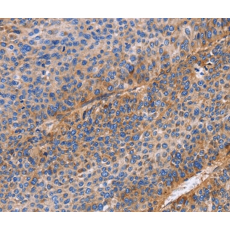 Immunohistochemistry - ITGB1 Antibody from Signalway Antibody (35784) - Antibodies.com