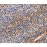 Immunohistochemistry - ITGB1 Antibody from Signalway Antibody (35784) - Antibodies.com
