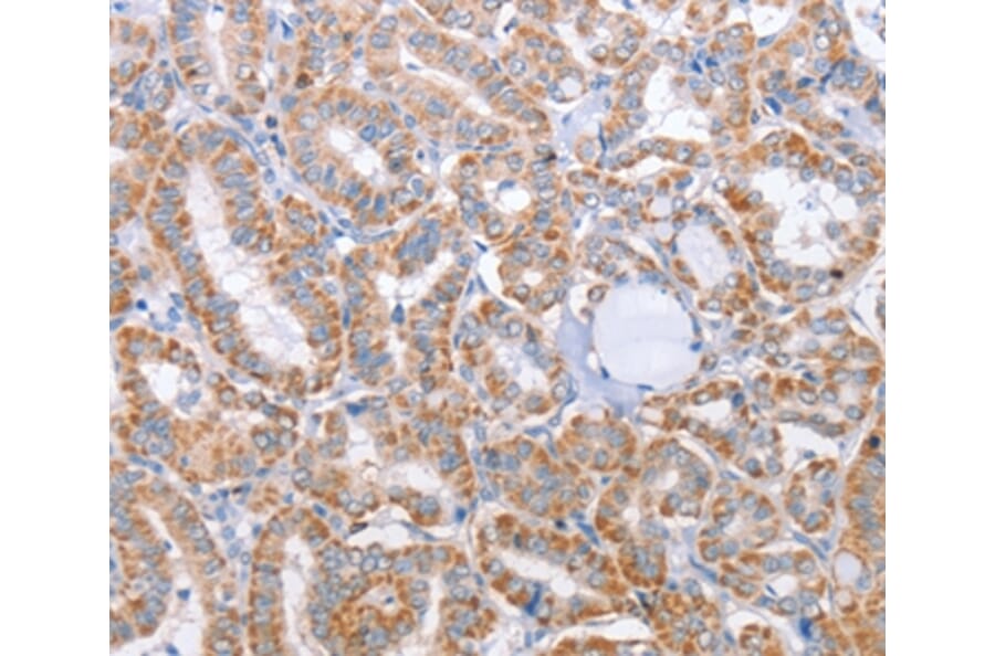Immunohistochemistry - KIF3A Antibody from Signalway Antibody (35795) - Antibodies.com