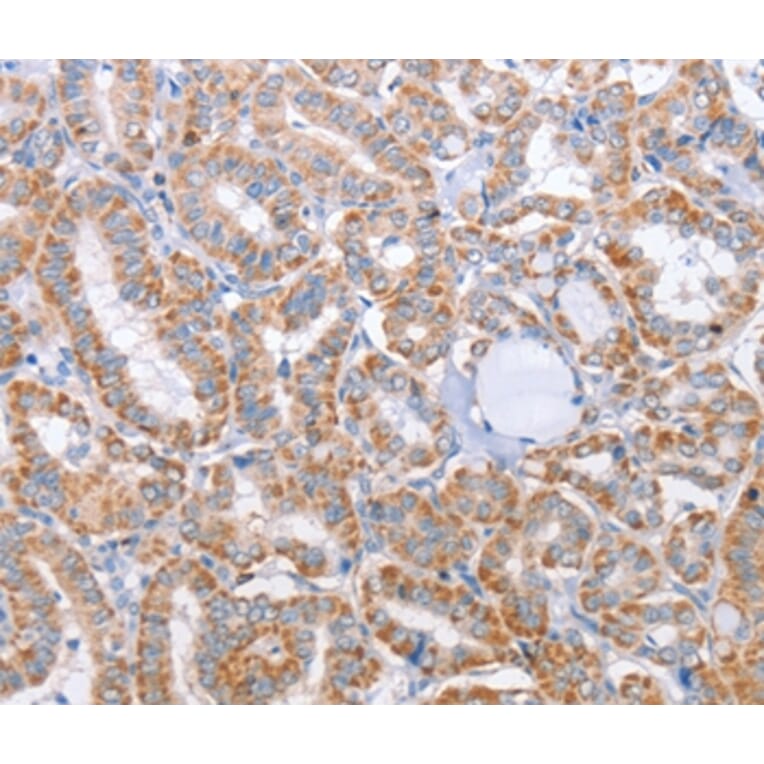 Immunohistochemistry - KIF3A Antibody from Signalway Antibody (35795) - Antibodies.com