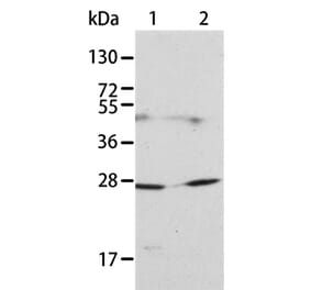 KLK15 Antibody from Signalway Antibody (35797) - Antibodies.com