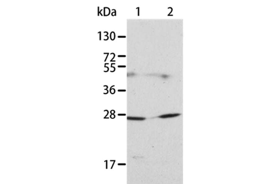 KLK15 Antibody from Signalway Antibody (35797) - Antibodies.com