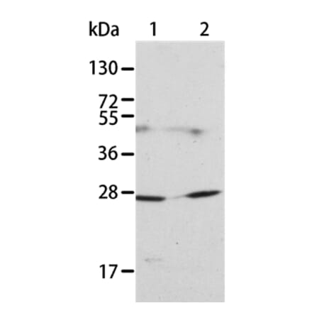 KLK15 Antibody from Signalway Antibody (35797) - Antibodies.com