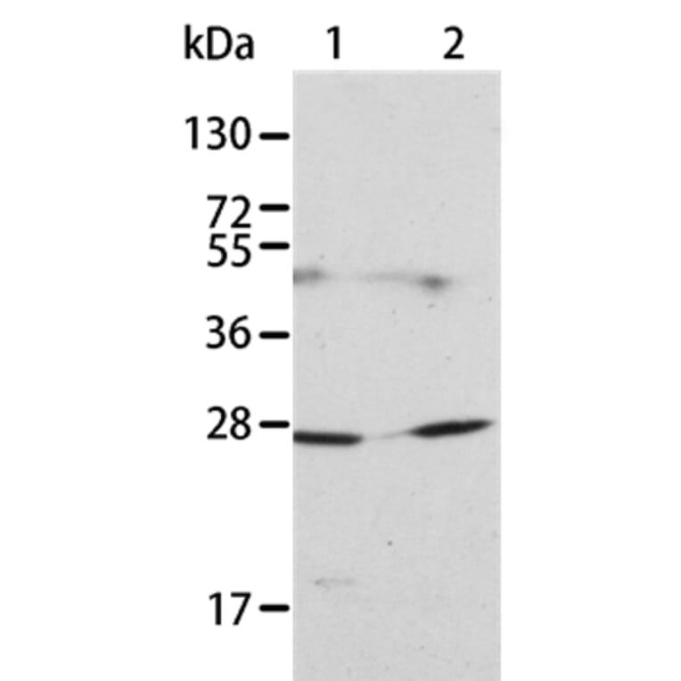 KLK15 Antibody from Signalway Antibody (35797) - Antibodies.com