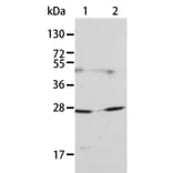 KLK15 Antibody from Signalway Antibody (35797) - Antibodies.com